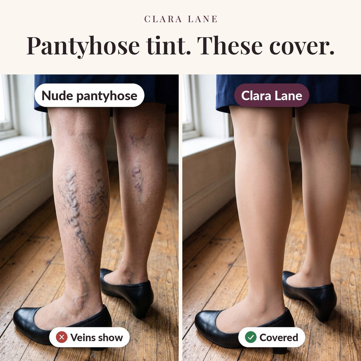 Nude pantyhose showing veins on both legs next to Clara Lane tights covering them